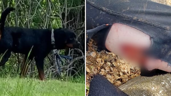 Woman left seriously injured after attack by 3 rottweilers in London, Ont.